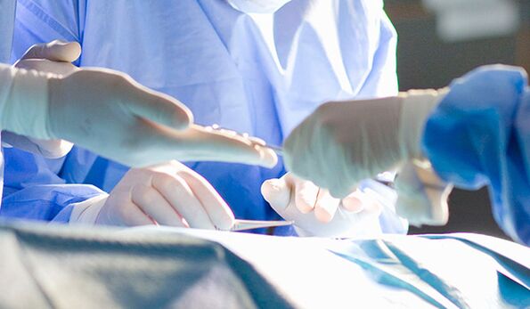 Operating on genitals